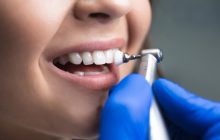 Dentálna hygiena: Aké prináša výhody?