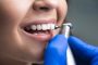 Dentálna hygiena: Aké prináša výhody?
